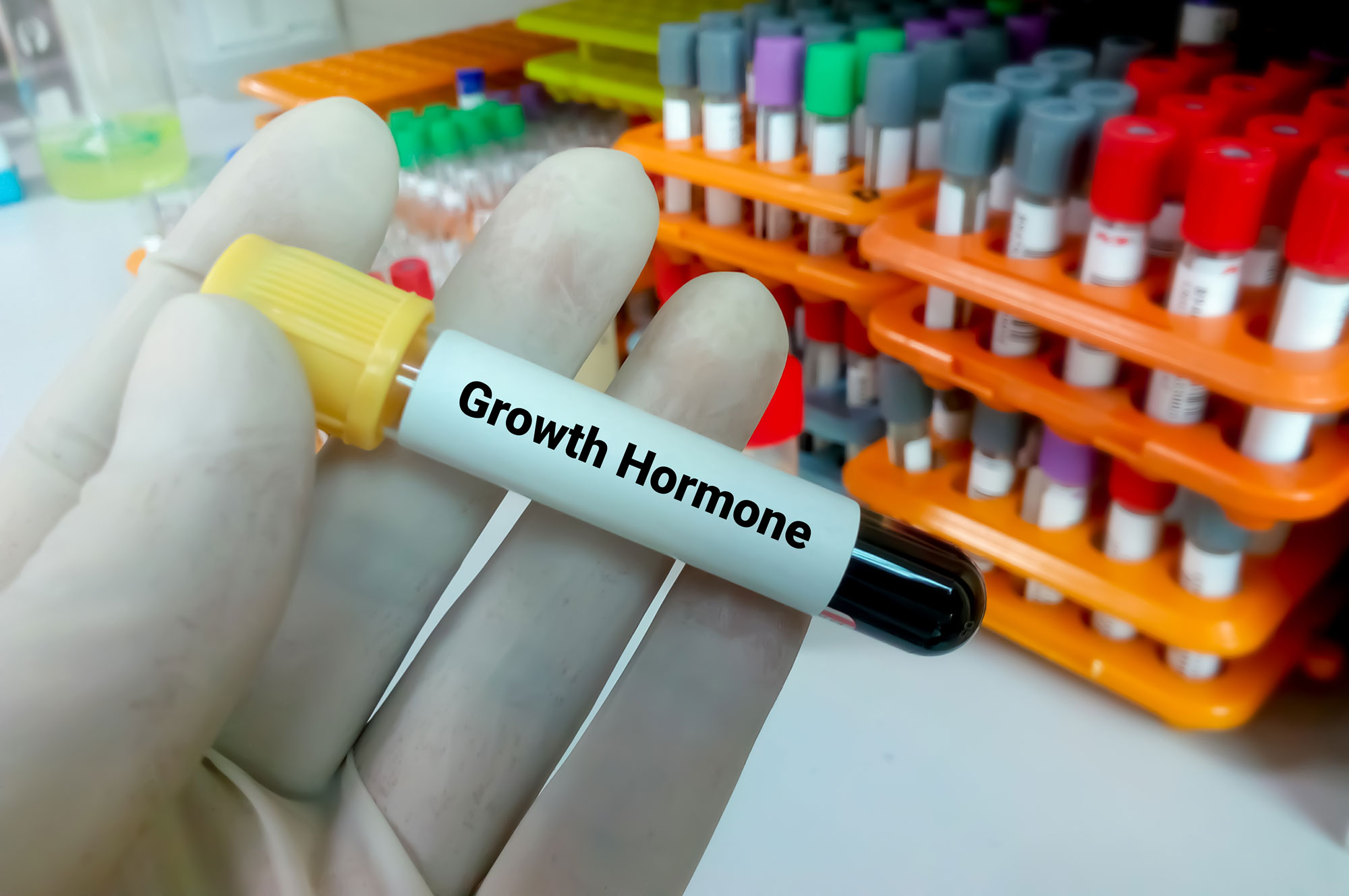 Sermorelin: Unlocking the Body’s Growth-Hormone Pathway for Longevity